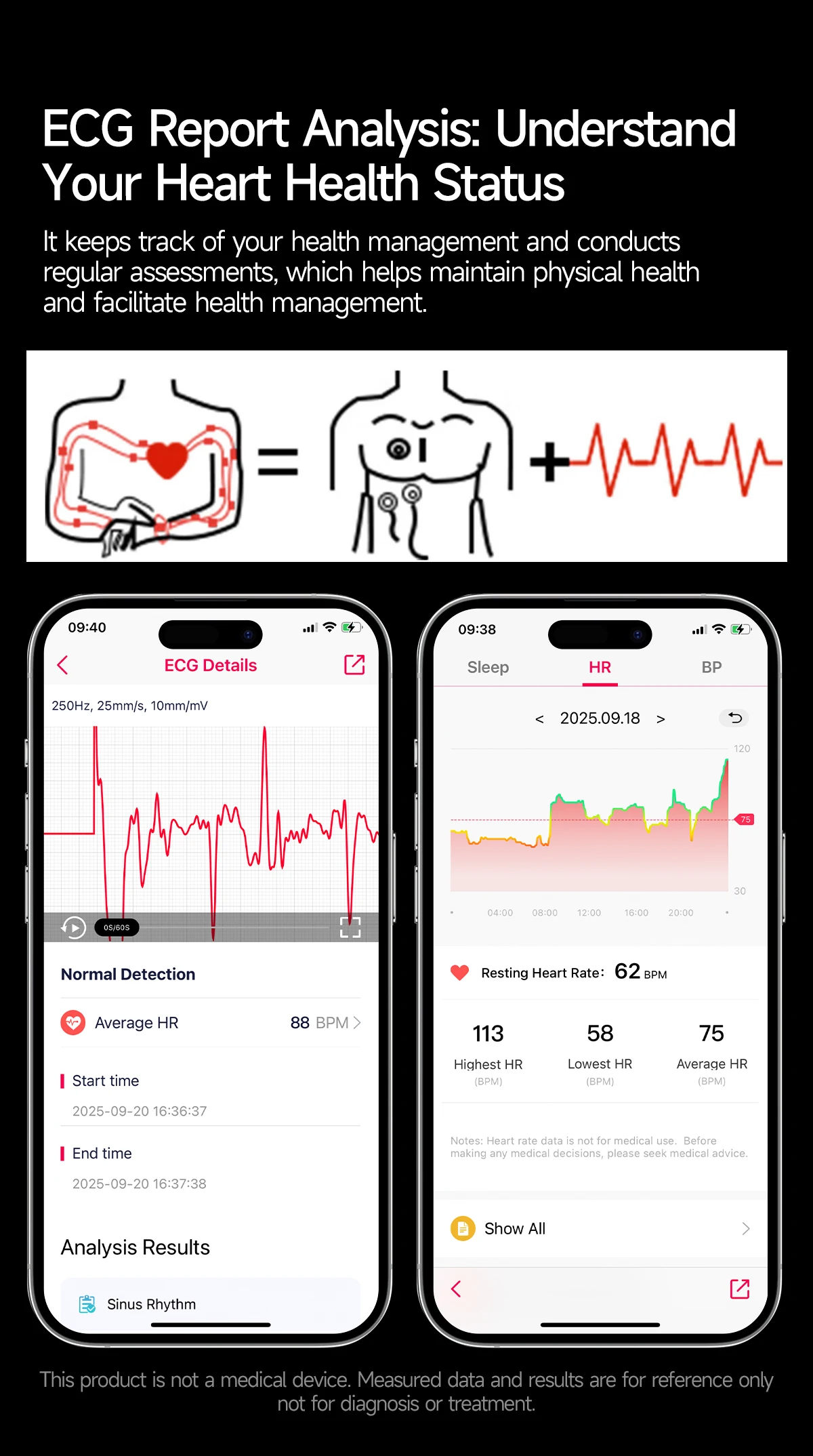 New Upgraded Heart Health Check Smart Watch Uric Acid Five Organ Examination Blood Pressure BT Call ECG smart watches Man 2026