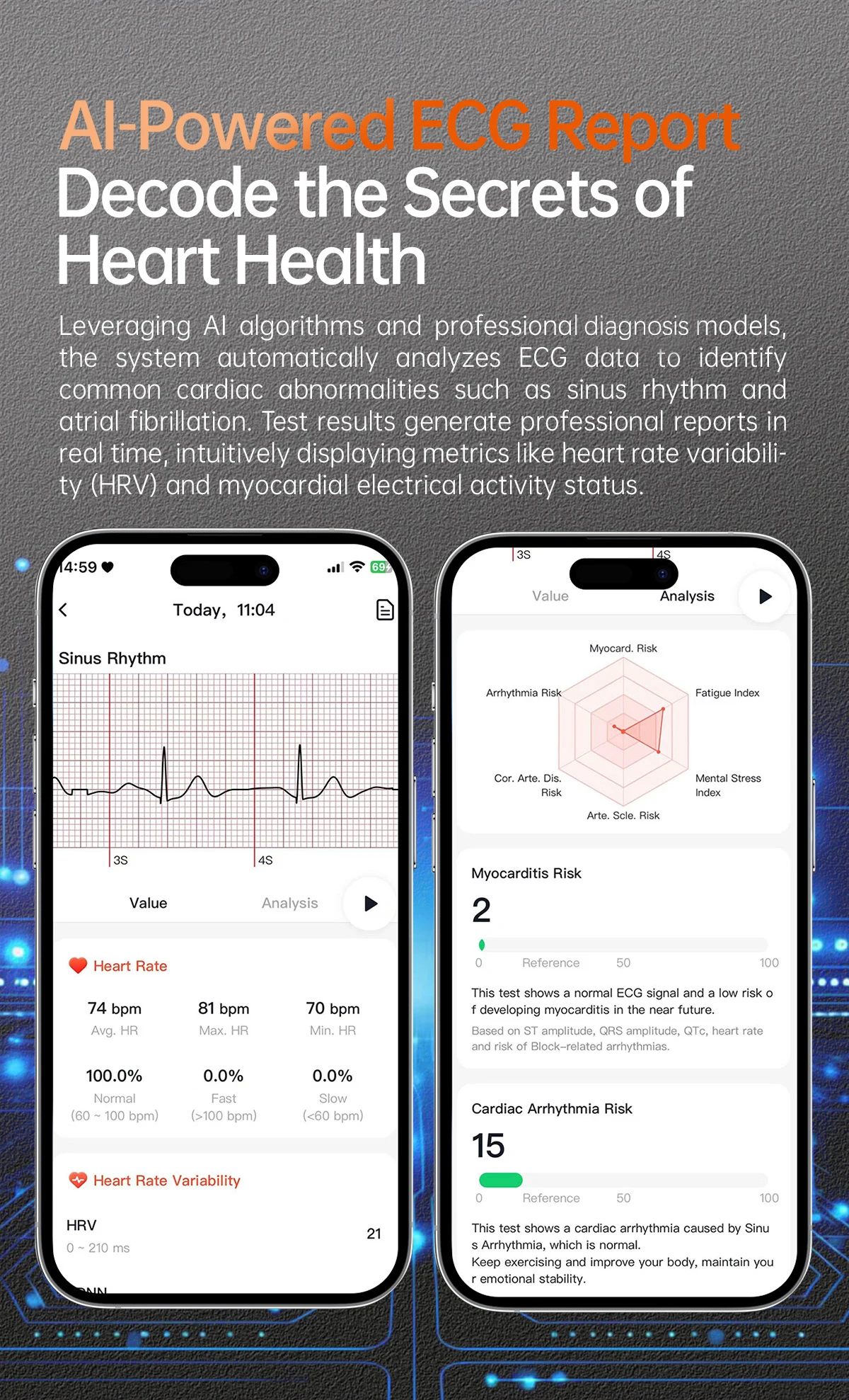 2025 New NFC+ECG+PPG Health Smart Watch BMI Fat Heart Rate Blood Pressure Watch 380mAh BT Call IP68 Waterproof Sports Bracelet